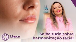 harmonização facial